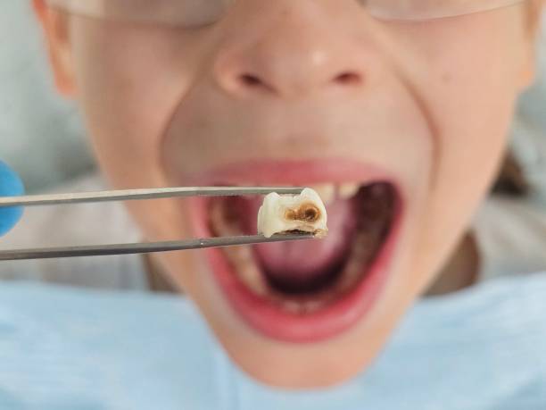Best Emergency Tooth Extraction  in Indian River Shores, FL