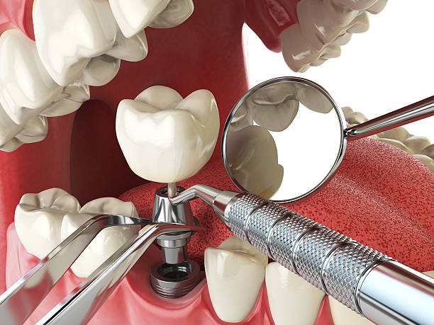 Emergency Dentist Open Today in FL